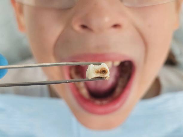 Best Pediatric Emergency Dentist in Richlands, NC